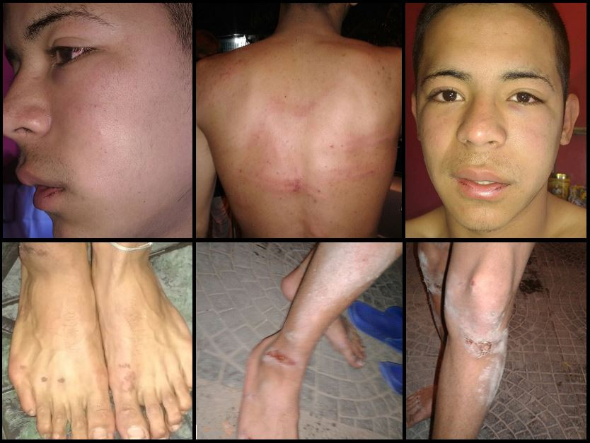 Prefectos torturaron a dos integrantes de La Garganta Poderosa